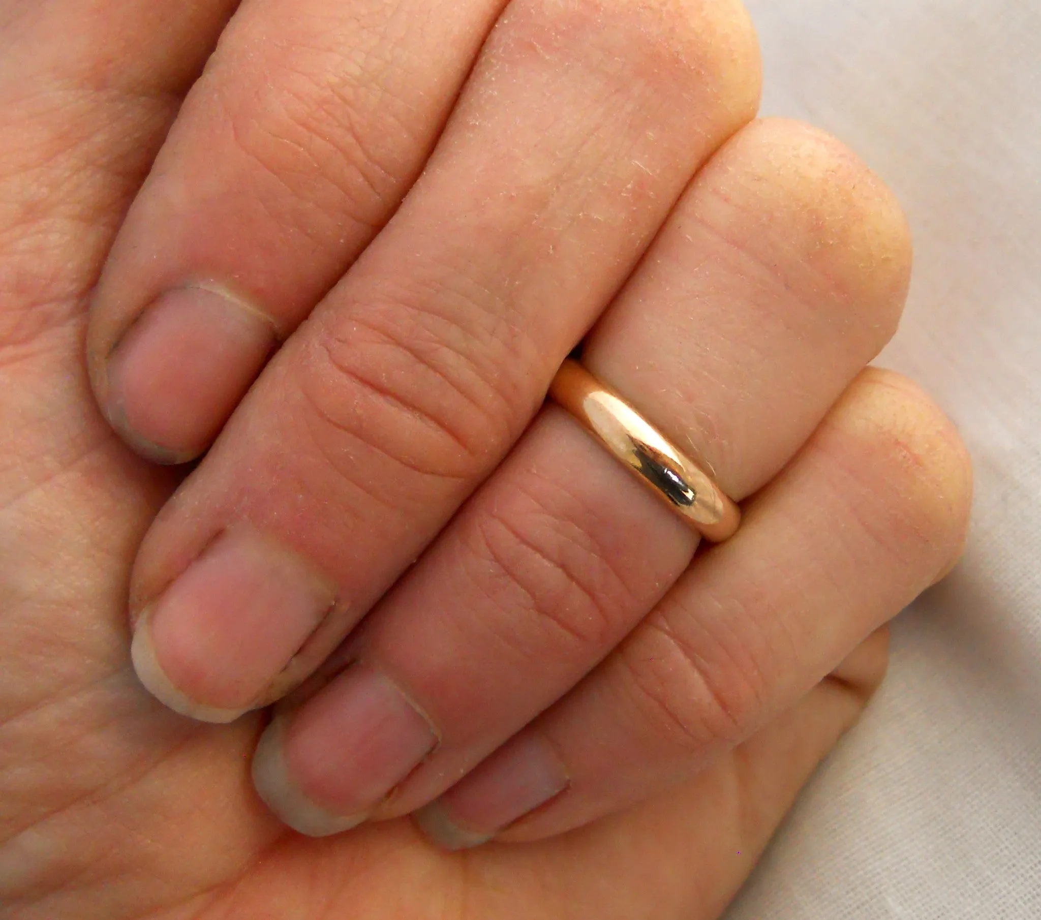 2.5mm Domed Band